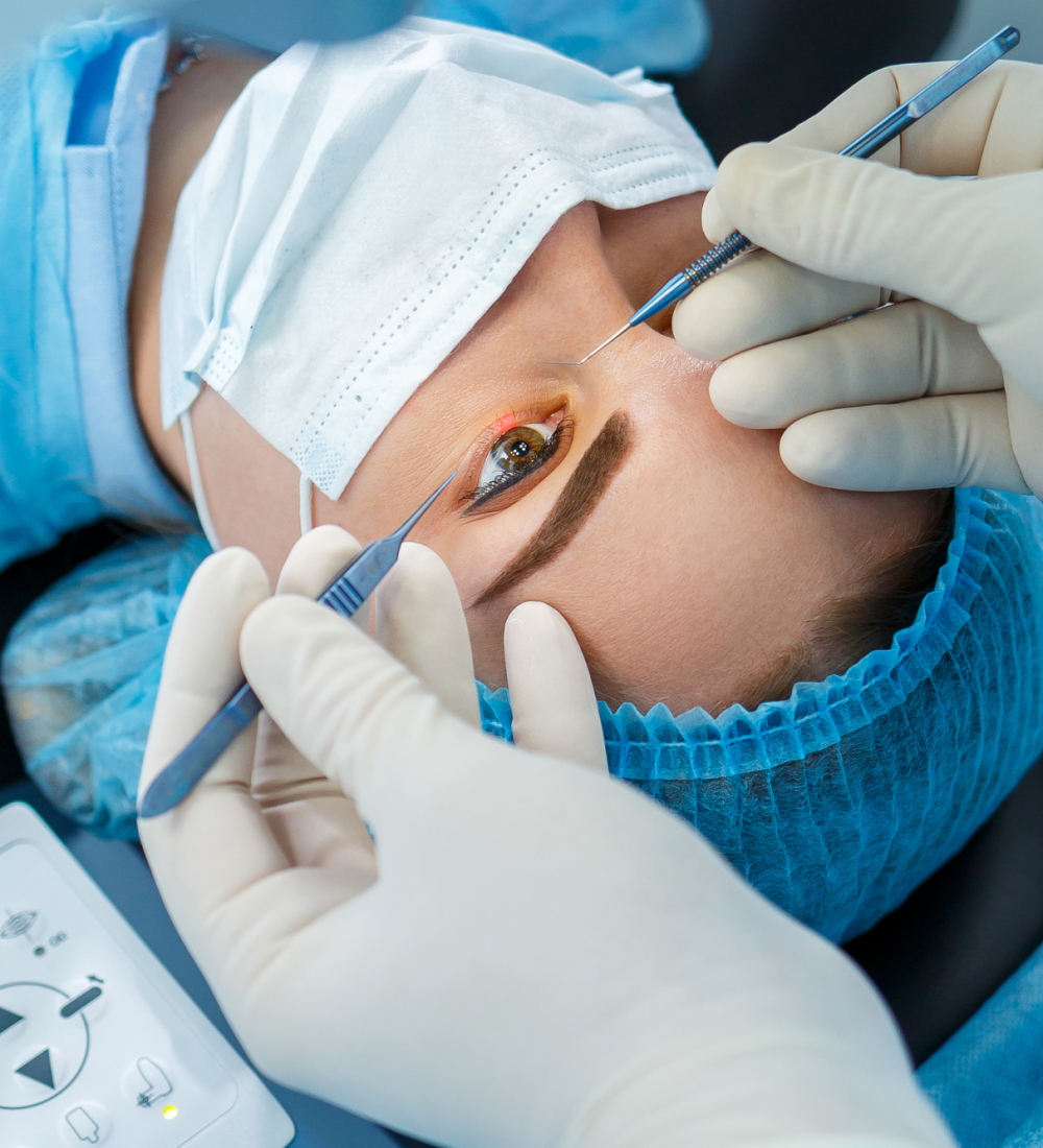 Relex Smile Eye Surgery
